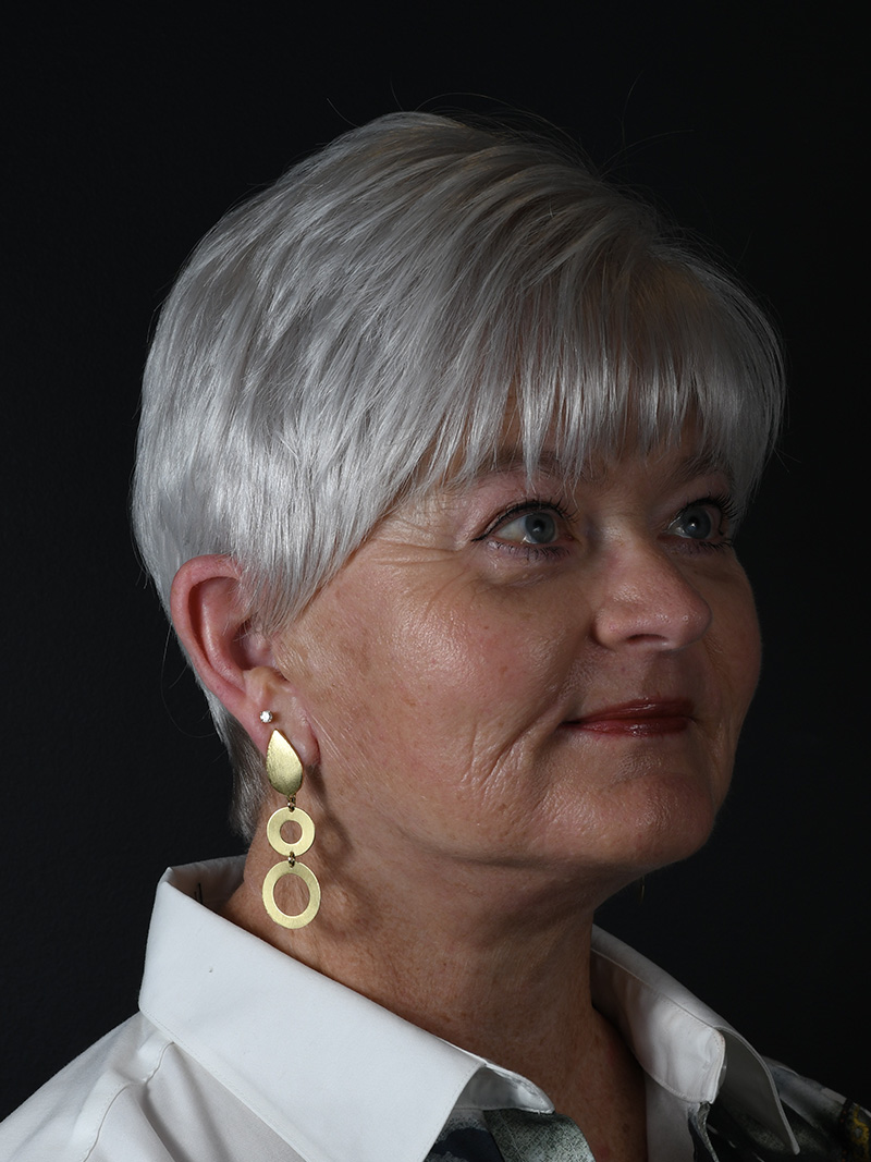 Co2 Laser Before and After | Northside Plastic Surgery